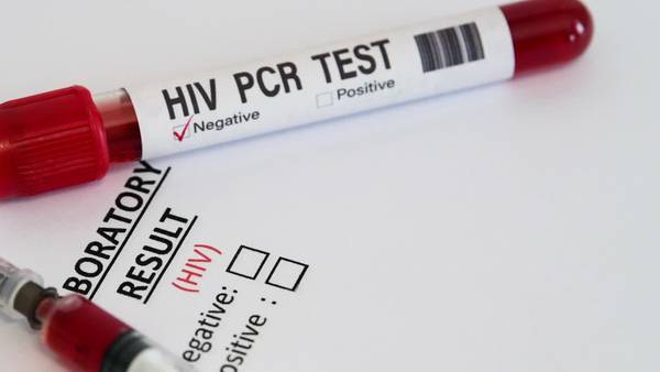Here are the locations offering free HIV testing in Central Florida
