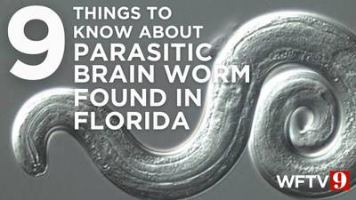 Angiostrongylus cantonensis: 9 things to know about parasitic brain worm found in Florida