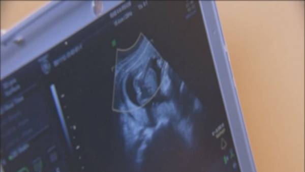 Florida law preventing abortions after 6 weeks of pregnancy goes into effect