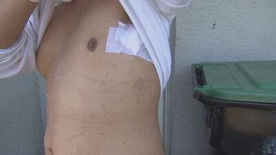 Only on 9: Central Florida teen recalls being shot by Ocoee police officer after shoplifting report