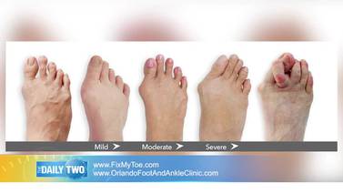 Daily Two: Orlando Foot & Ankle Clinic