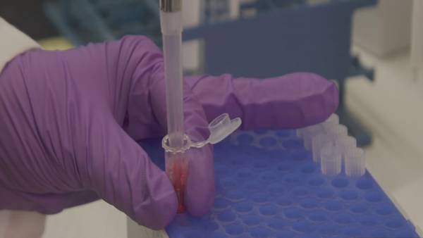 Orlando Health ORMC first in the world to use new blood test for traumatic brain injuries