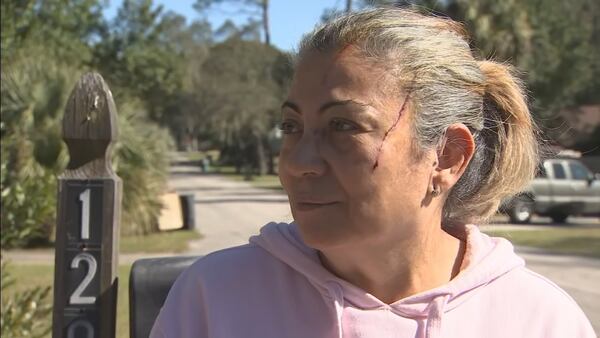 Video: Woman describes moment a mother bear attacked her while she was walking her dog